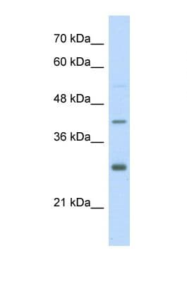 ARNT / HIF-1-Beta Antibody (aa81-130)