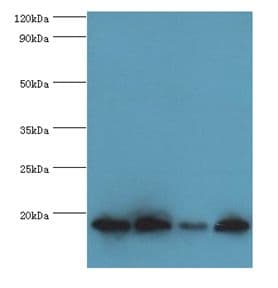IHC-plus™ MMS2 / UBE2V2 Antibody (aa1-145)