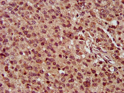 MMADHC / C2orf25 Antibody