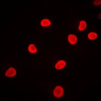 Polyclonal Rabbit anti-Human HNRNPF / hnRNP F Antibody (N-Terminus, IF, WB)