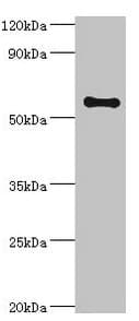 Polyclonal Rabbit anti-Human SCP2 / SCPX Antibody (aa1-322, IHC, WB)