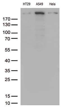 POLR2A / RNA polymerase II Antibody (aa1351-1614, clone OTI1E5)