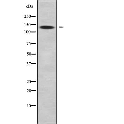 Polyclonal Rabbit anti-Human ARHGAP20 Antibody (IHC, WB)