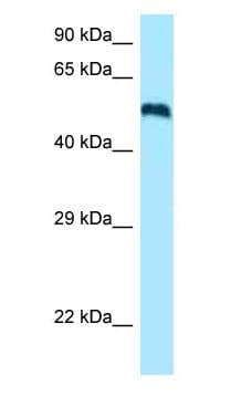 Polyclonal Rabbit anti-Human Ceramide Kinase / CERK Antibody (C-Terminus, WB)