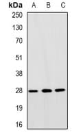RAP30 / GTF2F2 Antibody