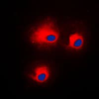 PRKCQ / PKC-Theta Antibody (phospho-Ser676)