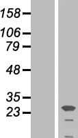 CSH1 / Placental Lactogen Protein (Over-Expression Lysate Myc-DDK (Flag))