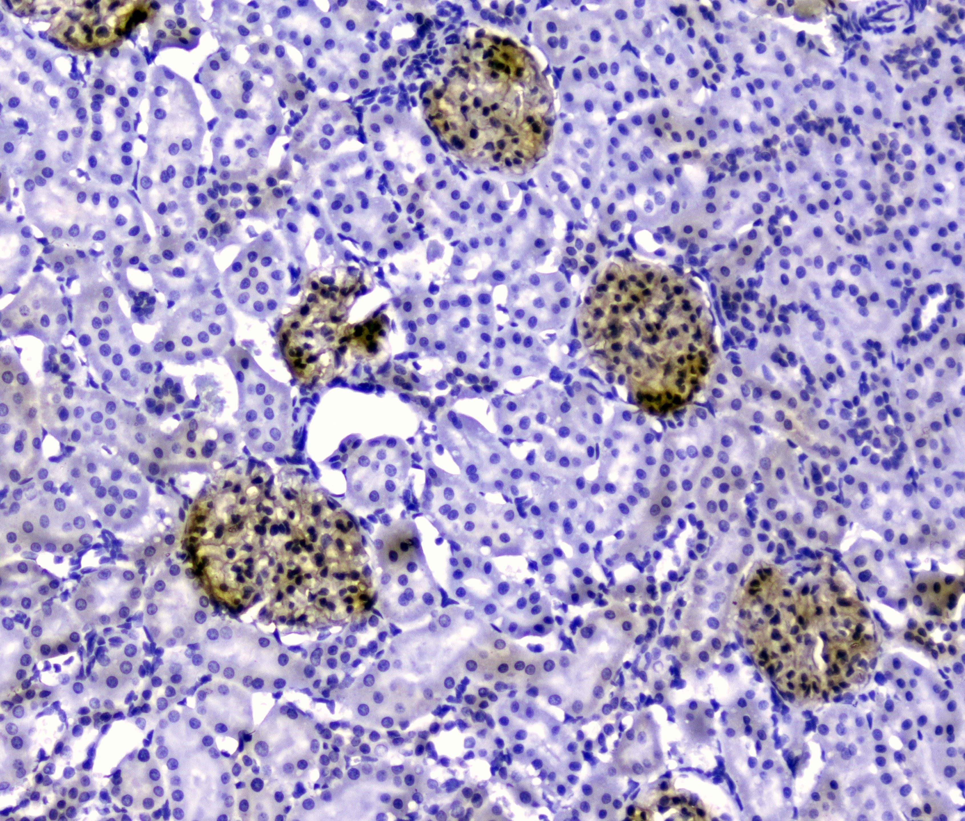 NPHS1 / Nephrin Antibody