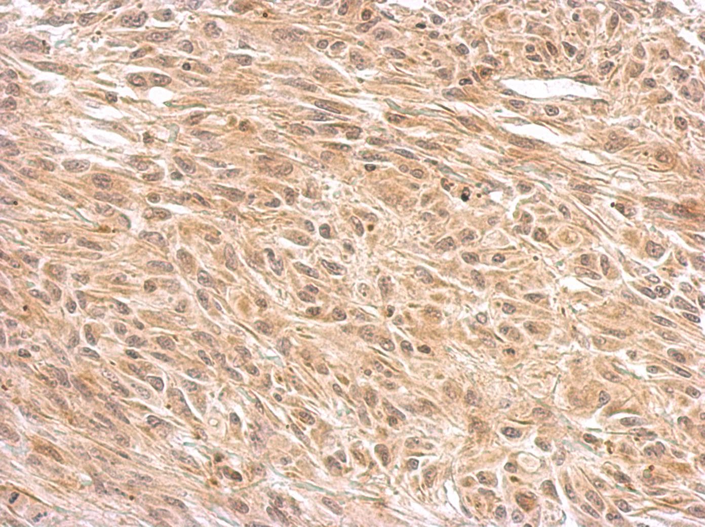 OGT / O-GLCNAC Antibody (aa1-280)