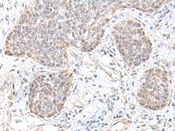 TCF25 Antibody