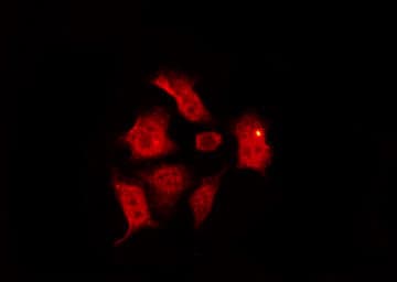 CHEK1 / CHK1 Antibody (phospho-Ser345)