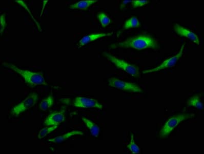 SLC5A8 / AIT Antibody