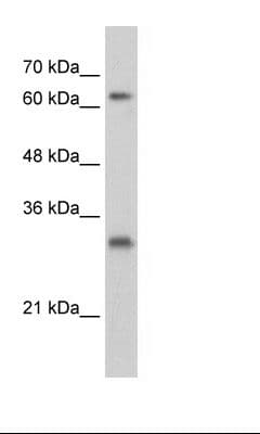 Polyclonal Rabbit anti-Human USP39 Antibody (N-Terminus, IHC, WB)