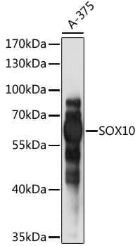 Polyclonal Rabbit anti-Human SOX10 Antibody (WB)