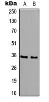 B3GALT6 Antibody (Internal)