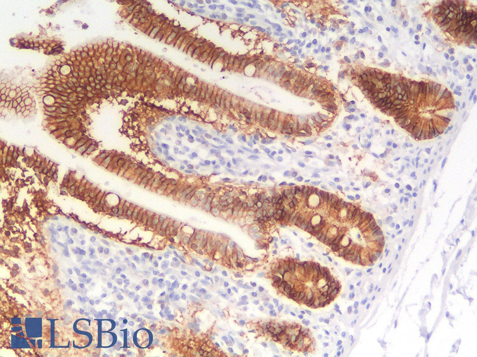 IHC-plus™ Recombinant Monoclonal Mouse anti-Human EPCAM Antibody (clone rEGP40/1110, aa 280-350, IHC)