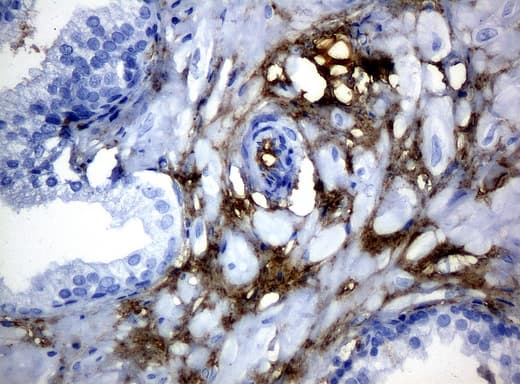 HP / Haptoglobin Antibody (clone UMAB10)