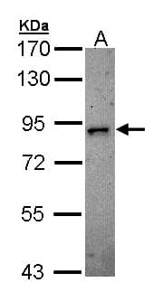 DCLK2 / DCAMKL2 Antibody (aa187-522)