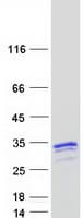 Human NAA40 Protein (Recombinant Myc-DDK (Flag))