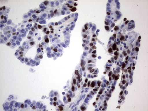 MKI67 / Ki67 Antibody (aa1160-1493, clone OTI6C12)