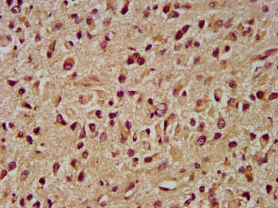 Polyclonal Rabbit anti-Human INPP5B Antibody (IHC, IF)