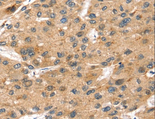 SORT1 / Sortilin Antibody