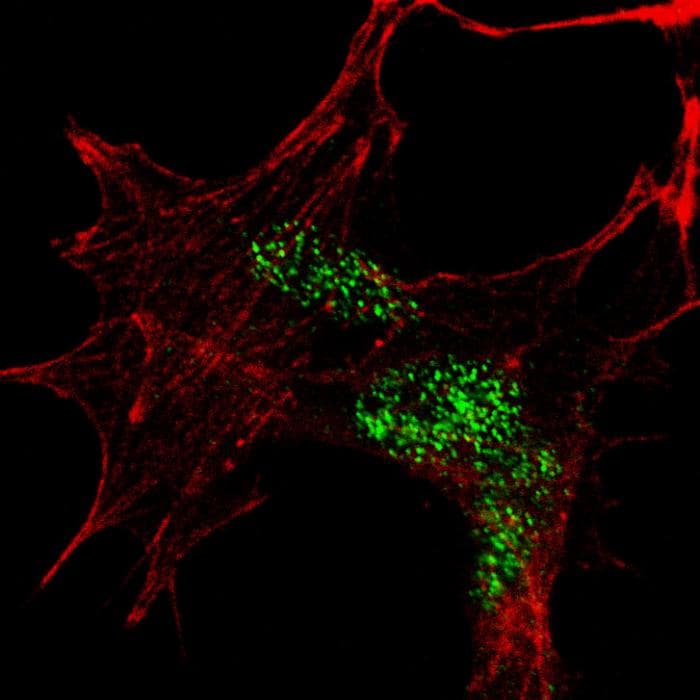 KLF4 Antibody (aa69-101)