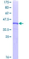 Human WFDC2 / HE4 Protein (Recombinant GST)