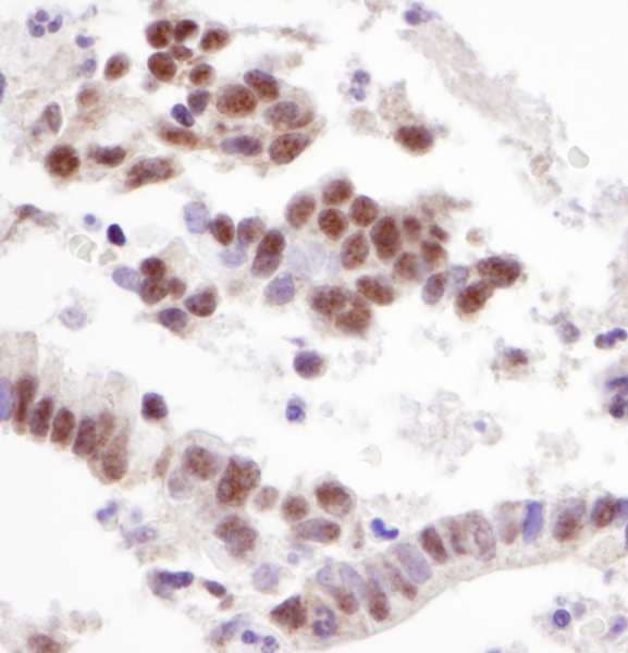 RBM39 Antibody (aa325-375)