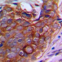 Polyclonal Rabbit anti-Human NPDC1 Antibody (Internal, IHC, WB)