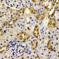 PSMB9 Antibody