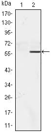 Monoclonal Mouse anti-Human NACC1 / NAC1 Antibody (clone 6H2, IHC, WB)