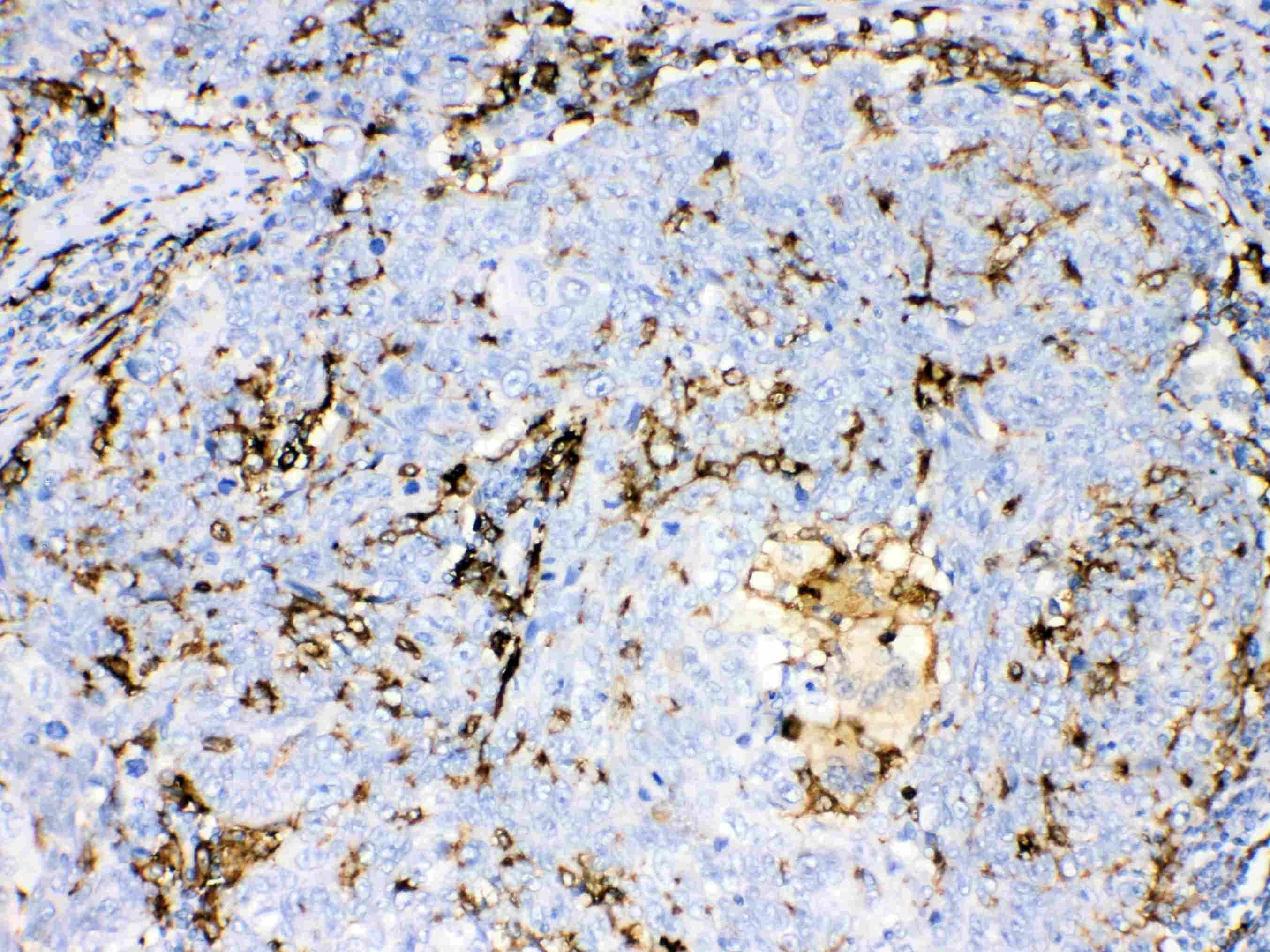 AIF1 / IBA1 Antibody
