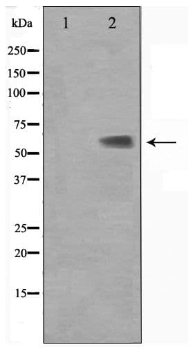 Polyclonal Rabbit anti-Human KLF11 Antibody (WB)