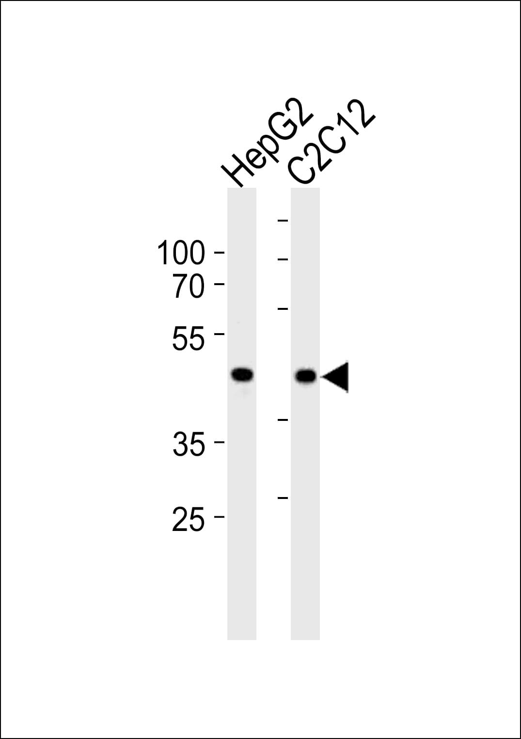Polyclonal Rabbit anti-Human SMAD3 Antibody (aa186-215, IHC, IF, WB)