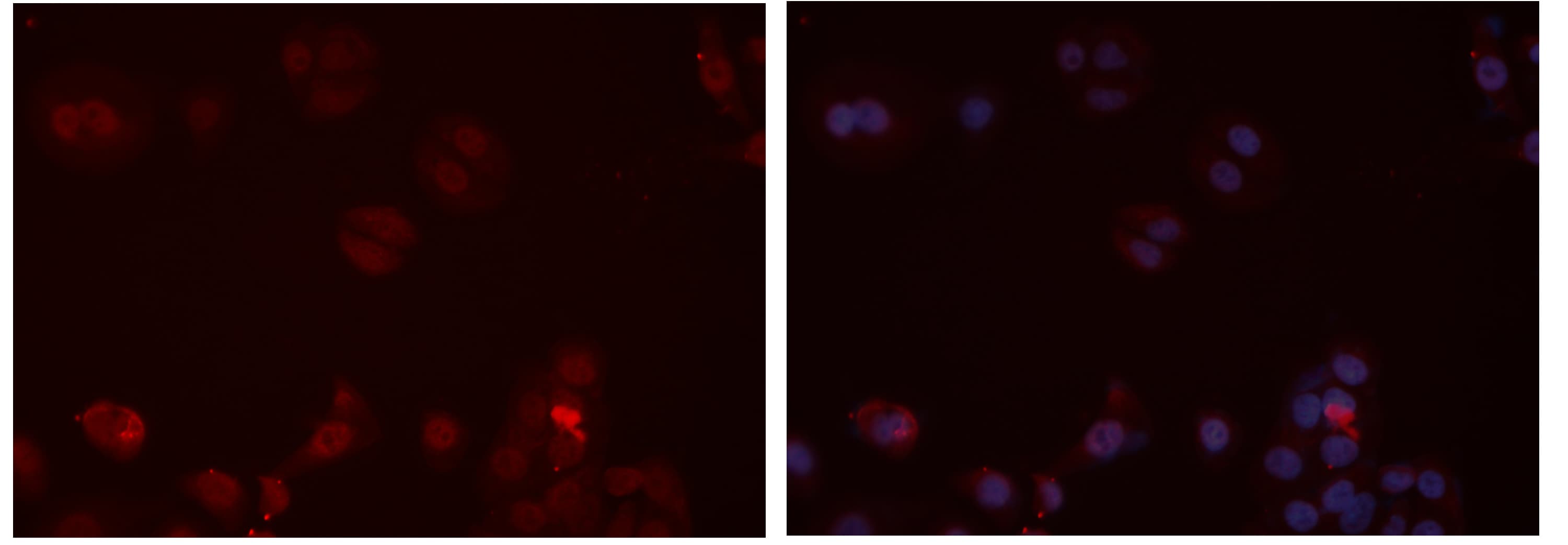 CX3CR1 Antibody