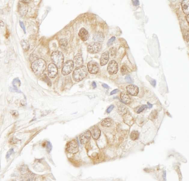 RAD9A / RAD9 Antibody (aa350-C-term)
