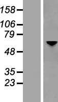 OPTN / Optineurin Protein (Over-Expression Lysate Myc-DDK (Flag))