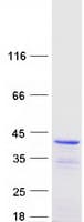 Human DNAJC17 Protein (Recombinant Myc-DDK (Flag))