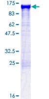 Human ACTN1 Protein (Recombinant GST)