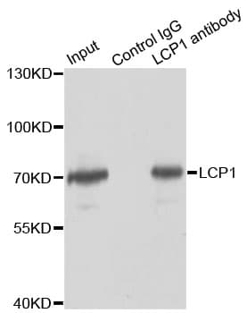 LCP1 / L-Plastin Antibody