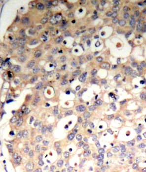Polyclonal Rabbit anti-Human PTPN6 / SHP1 Antibody (phospho-Tyr536, IHC, IF)