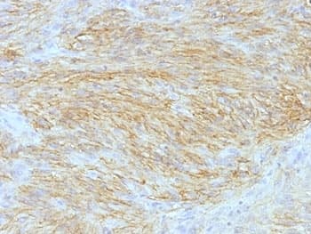 ANO1 / DOG1 / TMEM16A Antibody (clone SPM580, Azide-free, BSA-free)