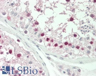 IHC-plus™ XPO5 / Exportin 5 Antibody (aa1154-1204)