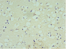 Polyclonal Rabbit anti-Human ATF7 Antibody (aa1-117, IHC, WB)