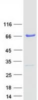 Human PRMT3 Protein (Recombinant Myc-DDK (Flag))