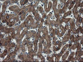 SKIL / SNO / SnoN Antibody (clone OTI3F6)