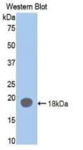 F2 / Prothrombin / Thrombin Antibody (Biotin)