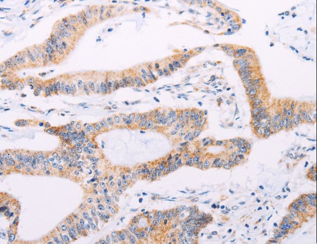 ADAMTS16 Antibody