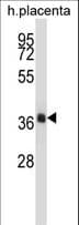Polyclonal Rabbit anti-Human NKX2-4 Antibody (aa2-29, WB)